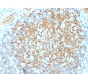 Immunohistochemistry - Anti-Integrin beta 3 Antibody [ITGB3/2145] (A249082) - Antibodies.com