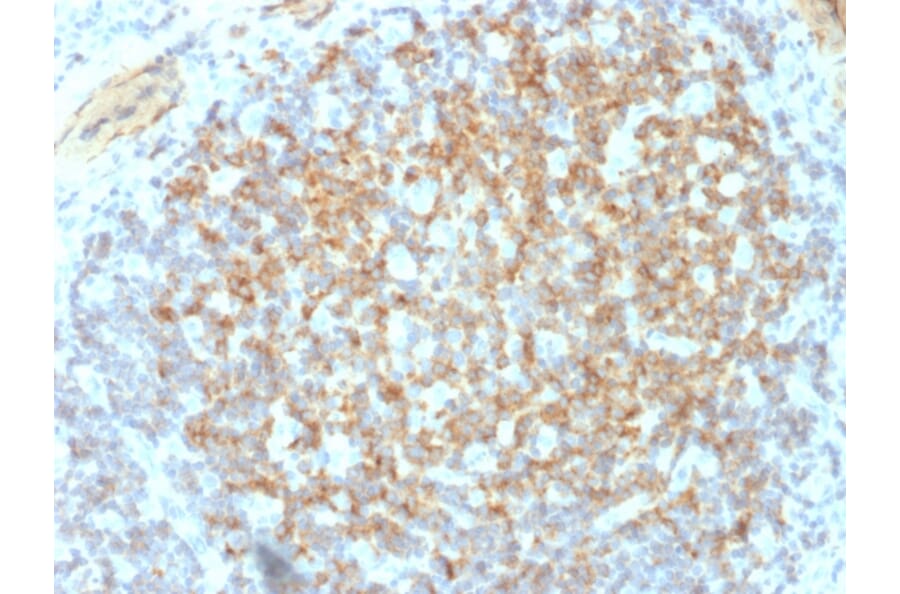 Immunohistochemistry - Anti-Integrin beta 3 Antibody [ITGB3/2145] (A249082) - Antibodies.com