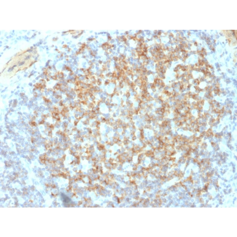 Immunohistochemistry - Anti-Integrin beta 3 Antibody [ITGB3/2145] (A249082) - Antibodies.com