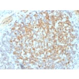 Immunohistochemistry - Anti-Integrin beta 3 Antibody [ITGB3/2145] (A249082) - Antibodies.com