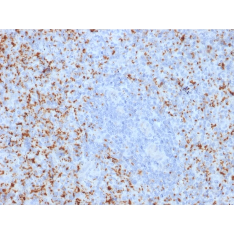 Immunohistochemistry - Anti-Integrin beta 3 Antibody [ITGB3/2145] (A249082) - Antibodies.com