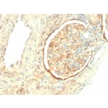 Immunohistochemistry - Anti-Integrin beta 3 Antibody [ITGB3/2145] (A249081) - Antibodies.com