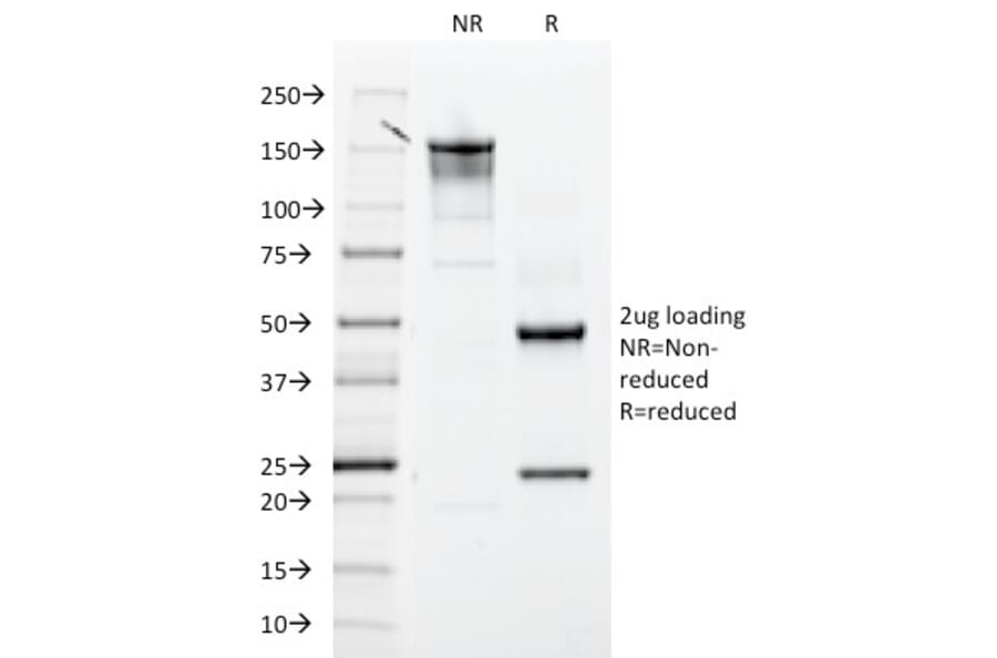 SDS-PAGE - Anti-Integrin beta 3 Antibody [ITGB3/2145] (A249082) - Antibodies.com