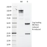 SDS-PAGE - Anti-Integrin beta 3 Antibody [ITGB3/2145] (A249082) - Antibodies.com