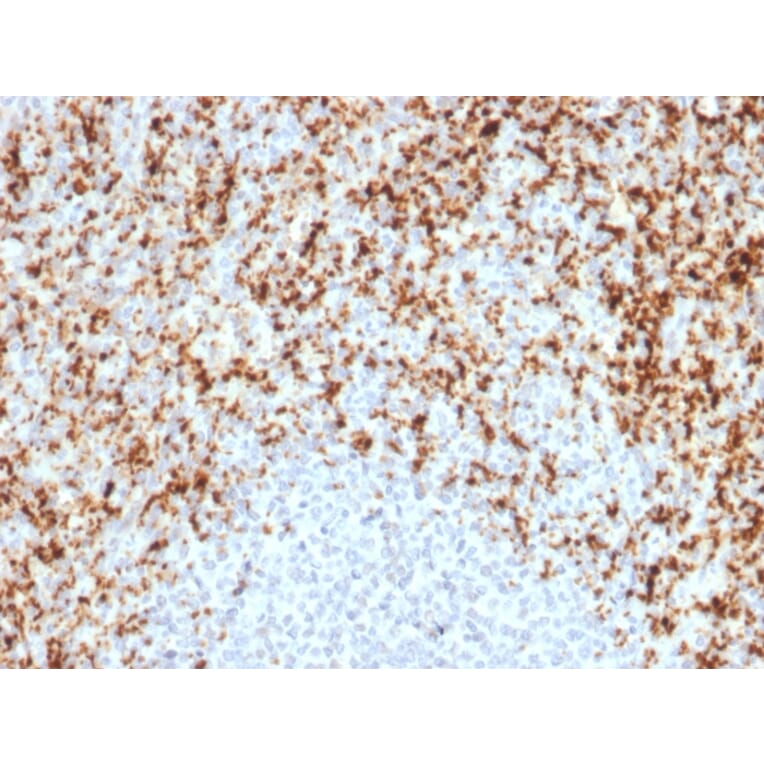 Immunohistochemistry - Anti-Integrin beta 3 Antibody [ITGB3/2597] (A249082) - Antibodies.com