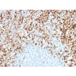 Immunohistochemistry - Anti-Integrin beta 3 Antibody [ITGB3/2597] (A249082) - Antibodies.com