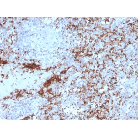 Immunohistochemistry - Anti-Integrin beta 3 Antibody [rITGB3/2145] (A249083) - Antibodies.com