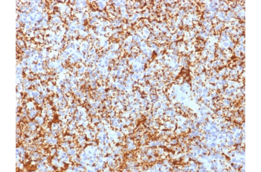 Immunohistochemistry - Anti-Integrin beta 3 Antibody [ITGB3/2166R] (A249085) - Antibodies.com