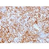 Immunohistochemistry - Anti-Integrin beta 3 Antibody [ITGB3/2166R] (A249085) - Antibodies.com