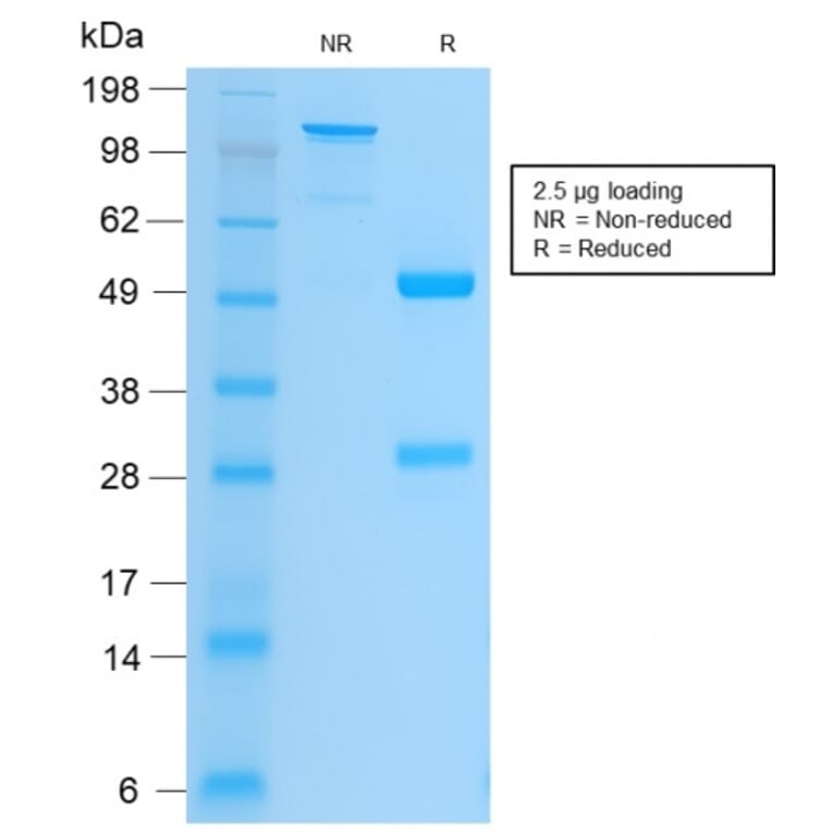 SDS-PAGE - Anti-Integrin beta 3 Antibody [ITGB3/2166R] (A249085) - Antibodies.com