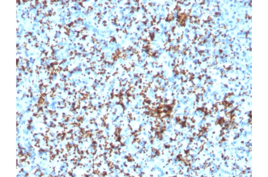 Immunohistochemistry - Anti-Integrin beta 3 Antibody [ITGB3/3126R] (A249085) - Antibodies.com