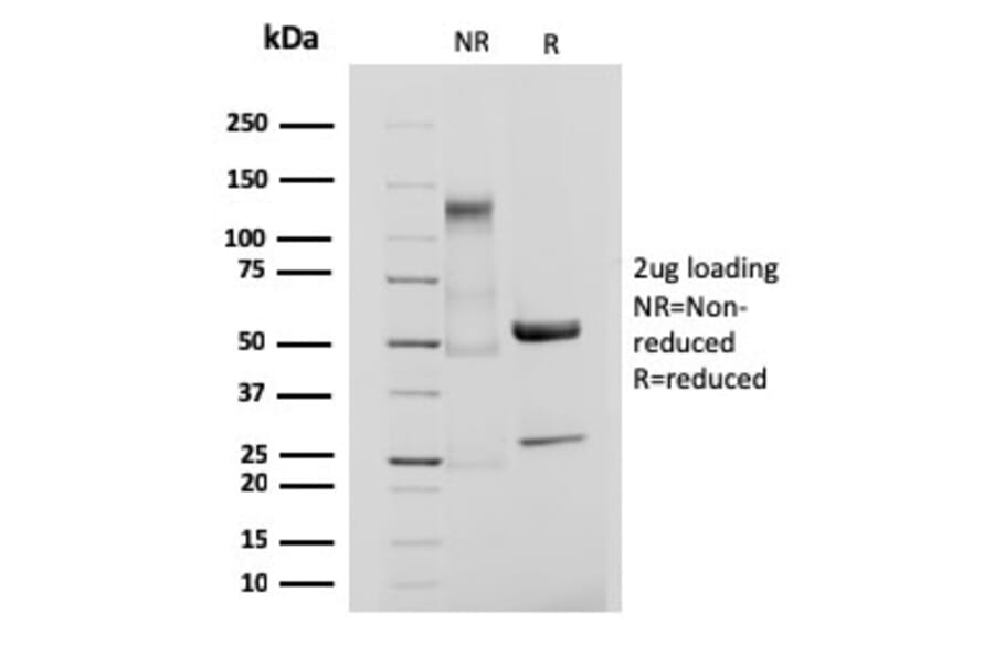 SDS-PAGE - Anti-Integrin beta 3 Antibody [ITGB3/3126R] (A249086) - Antibodies.com