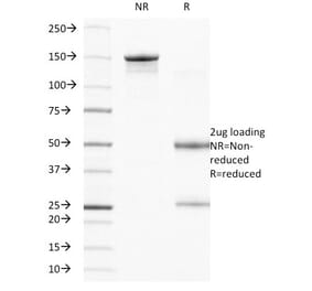 SDS-PAGE - Anti-Integrin beta 4 Antibody [UM-A9] (A249086) - Antibodies.com