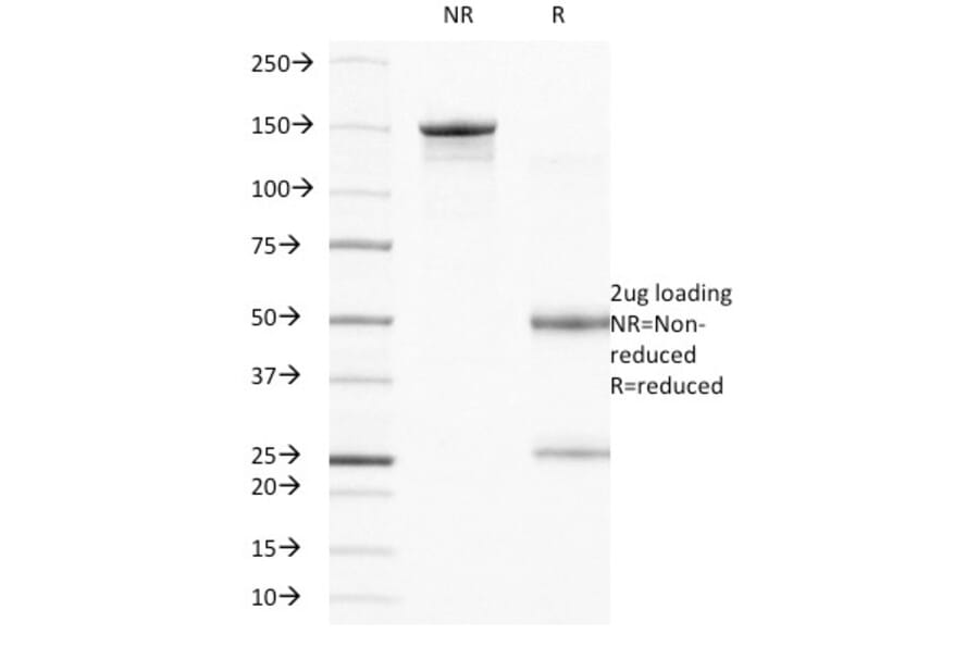 SDS-PAGE - Anti-Integrin beta 4 Antibody [UM-A9] (A249086) - Antibodies.com