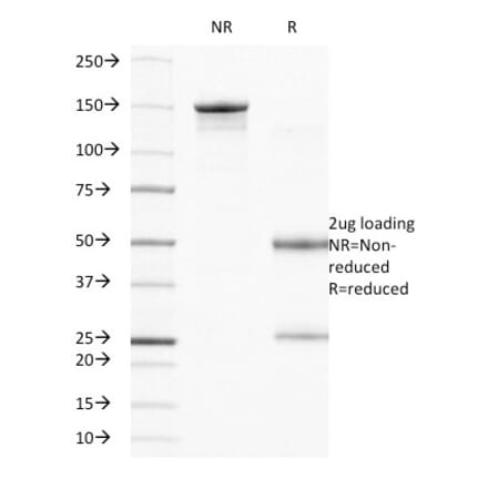 SDS-PAGE - Anti-Integrin beta 4 Antibody [UM-A9] (A249086) - Antibodies.com