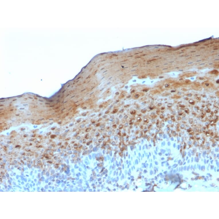 Immunohistochemistry - Anti-Involucrin Antibody [SY5] (A249087) - Antibodies.com