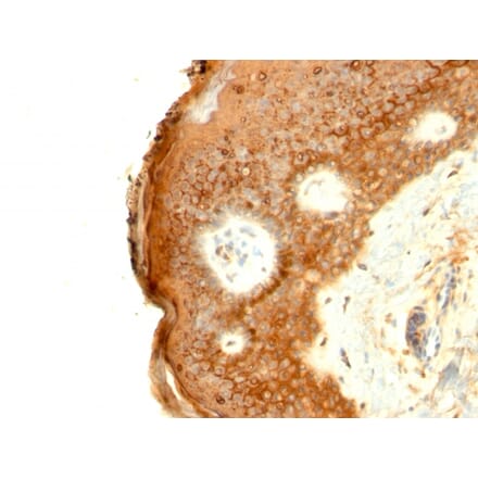 Immunohistochemistry - Anti-Involucrin Antibody [SPM259] (A249088) - Antibodies.com