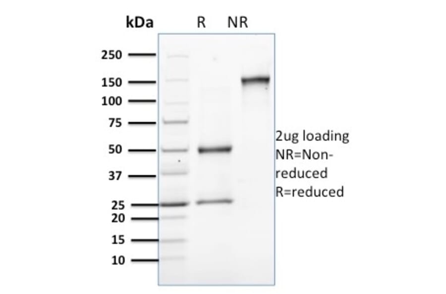 SDS-PAGE - Anti-Involucrin Antibody [SPM259] (A249089) - Antibodies.com
