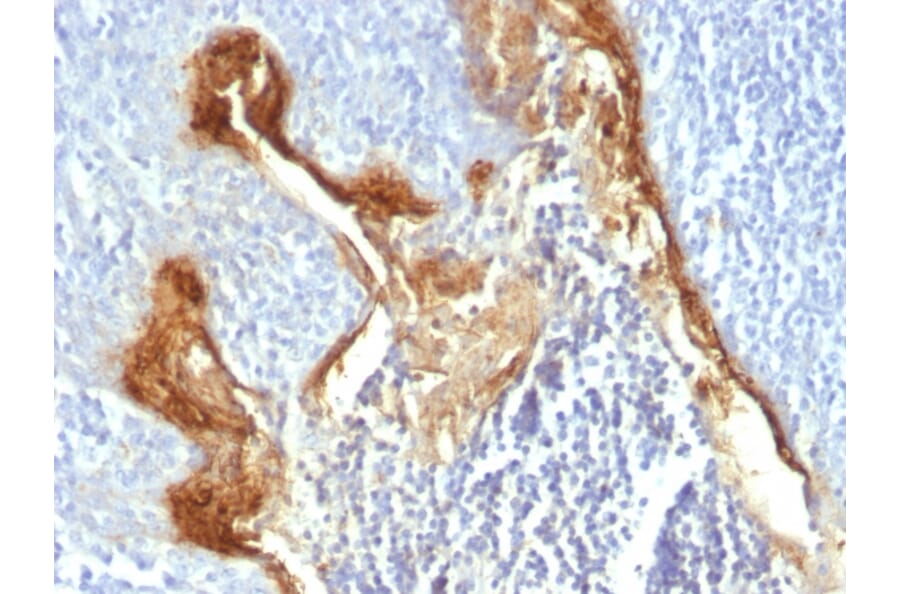 Immunohistochemistry - Anti-Involucrin Antibody [IVRN/827] (A249089) - Antibodies.com