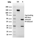 SDS-PAGE - Anti-Involucrin Antibody [rIVRN/827] (A249091) - Antibodies.com