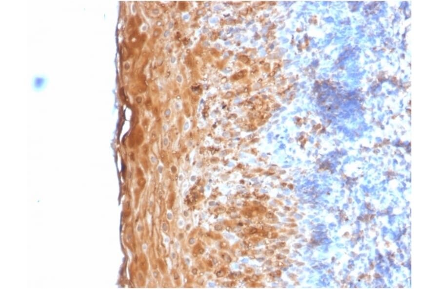 Immunohistochemistry - Anti-Involucrin Antibody [IVRN/2113R] (A249091) - Antibodies.com