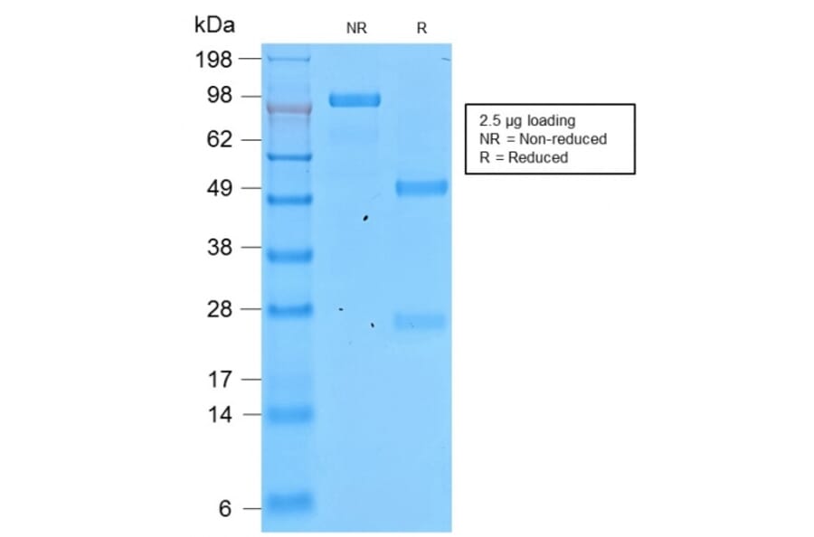 SDS-PAGE - Anti-Involucrin Antibody [IVRN/2113R] (A249092) - Antibodies.com