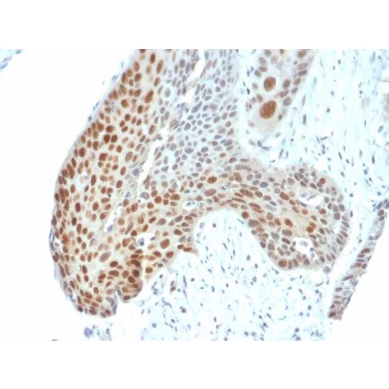 Immunohistochemistry - Anti-c-Jun (phospho Thr91 + Thr93) Antibody [C-J 4C4/1] (A249093) - Antibodies.com