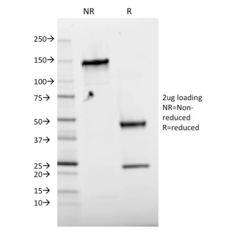 SDS-PAGE - Anti-c-Jun (phospho Thr91 + Thr93) Antibody [C-J 4C4/1] (A249093) - Antibodies.com