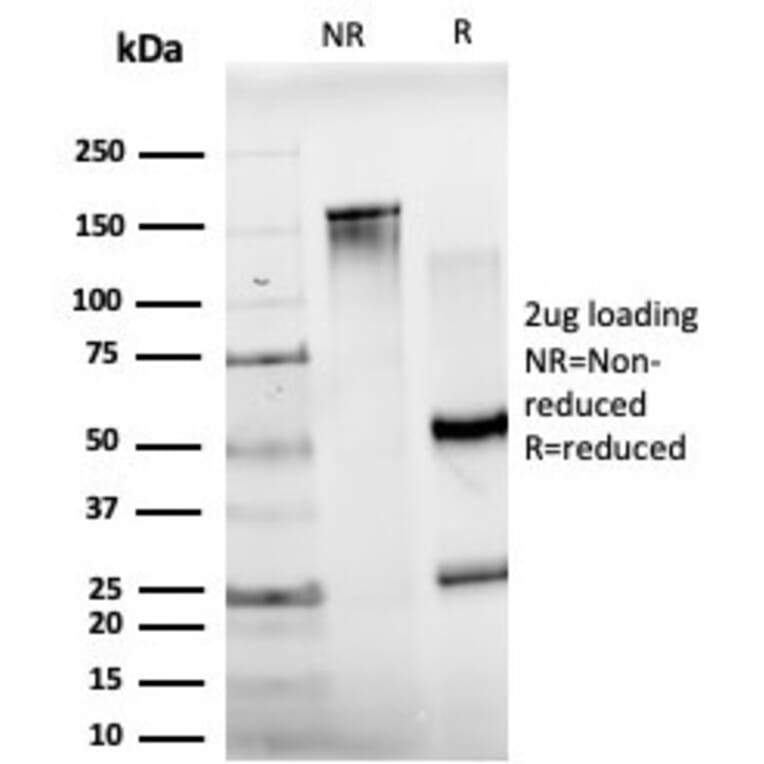 SDS-PAGE - Anti-JunB Antibody [PCRP-JUNB-3G11] (A249094) - Antibodies.com