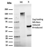 SDS-PAGE - Anti-JunB Antibody [PCRP-JUNB-3G11] (A249094) - Antibodies.com