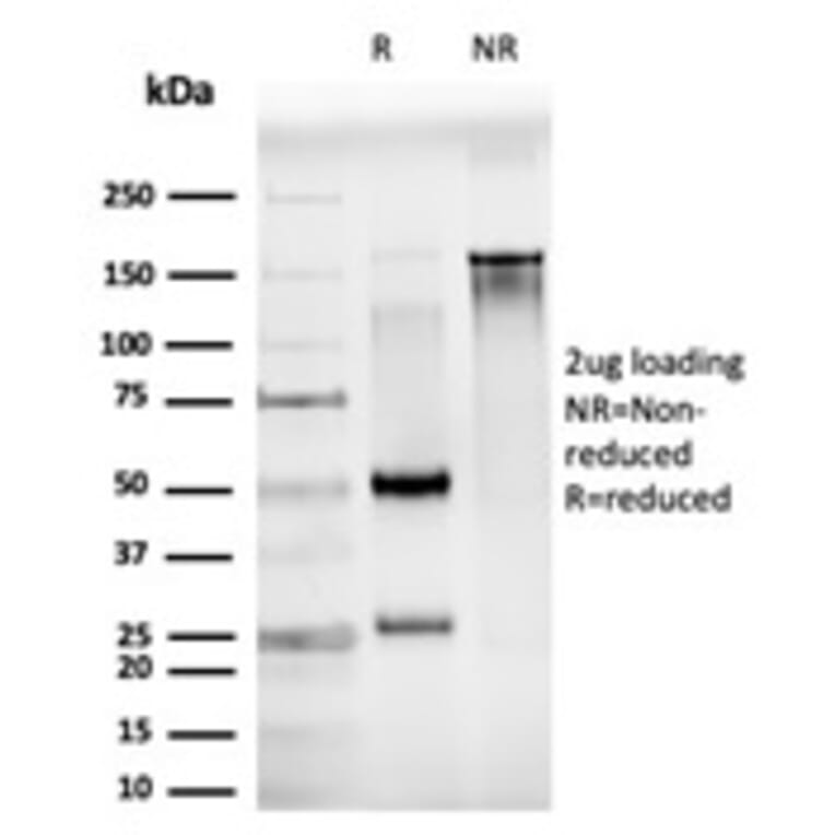 SDS-PAGE - Anti-JunB Antibody [PCRP-JUNB-3G2] (A249095) - Antibodies.com