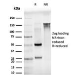 SDS-PAGE - Anti-JunB Antibody [PCRP-JUNB-3G2] (A249095) - Antibodies.com