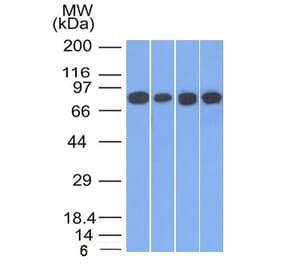 Western Blot - Anti-gamma Catenin Antibody [11E4] (A249096) - Antibodies.com