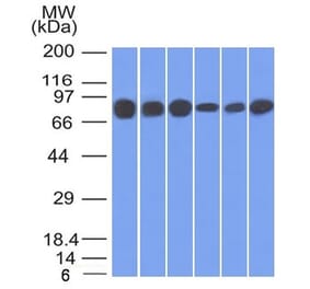 Western Blot - Anti-gamma Catenin Antibody [15F11] (A249097) - Antibodies.com