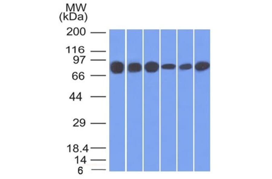 Western Blot - Anti-gamma Catenin Antibody [15F11] (A249097) - Antibodies.com