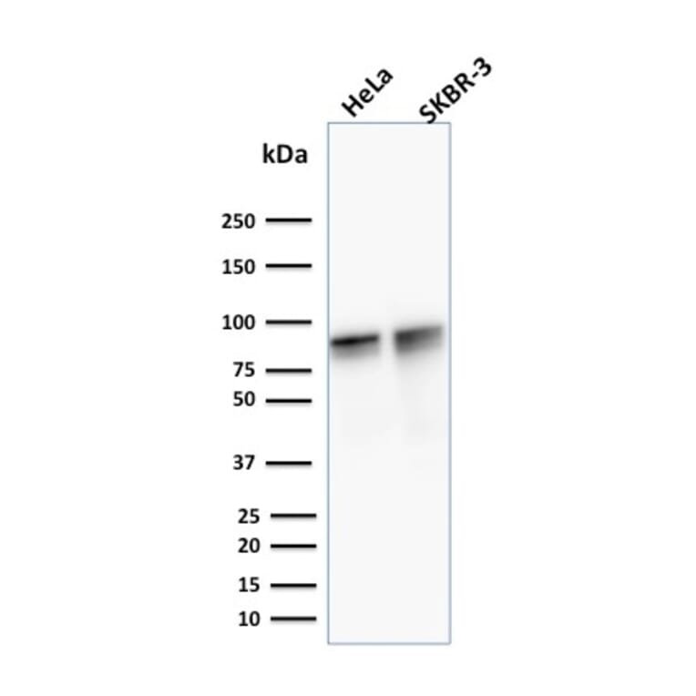 Western Blot - Anti-gamma Catenin Antibody [15F11] (A249097) - Antibodies.com
