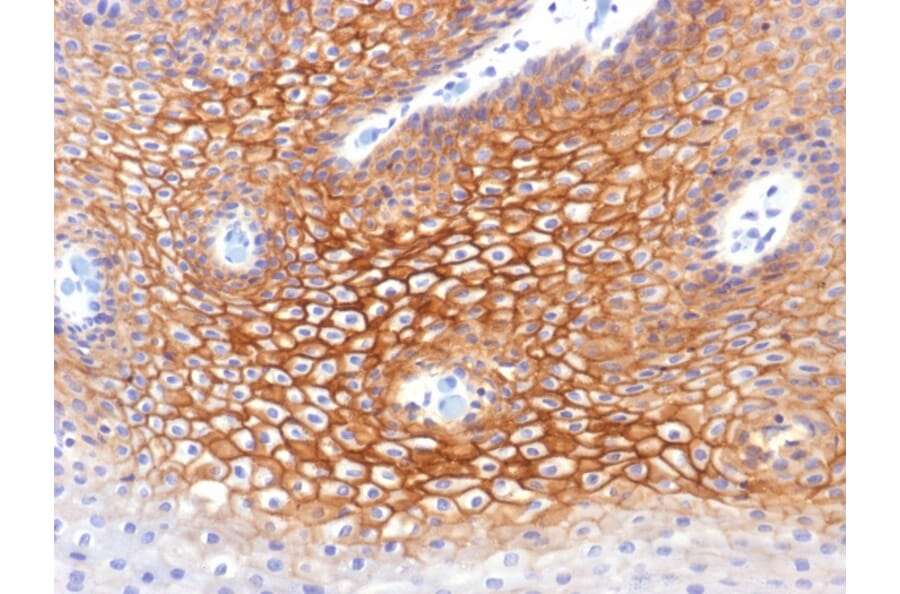 Immunohistochemistry - Anti-gamma Catenin Antibody [CTNG/1483] (A249097) - Antibodies.com