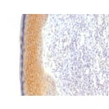 Immunohistochemistry - Anti-gamma Catenin Antibody [CTNG/1483] (A249098) - Antibodies.com