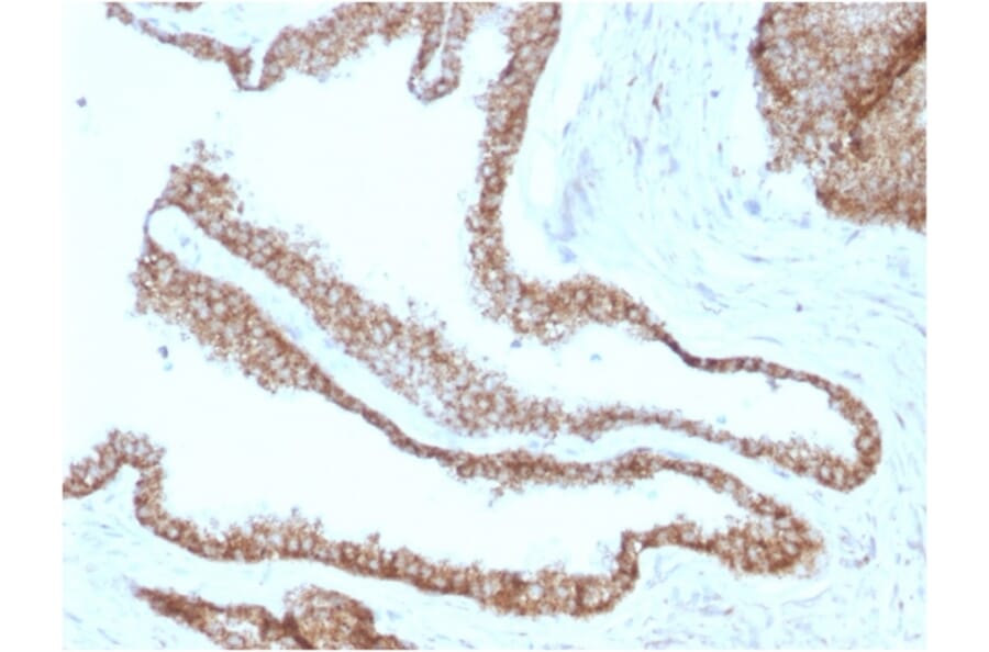Immunohistochemistry - Anti-gamma Catenin Antibody [CTNG/1664] (A249099) - Antibodies.com