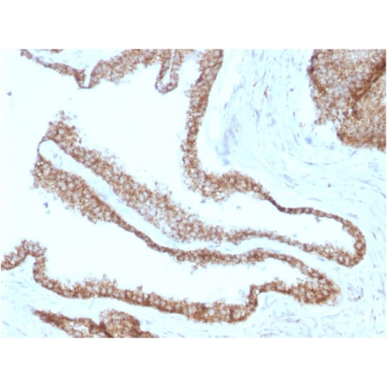 Immunohistochemistry - Anti-gamma Catenin Antibody [CTNG/1664] (A249099) - Antibodies.com