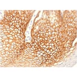 Immunohistochemistry - Anti-gamma Catenin Antibody [CTNG/1664] (A249099) - Antibodies.com