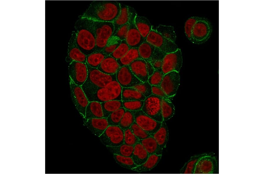Immunofluorescence - Anti-gamma Catenin Antibody [CTNG/1664] (A249098) - Antibodies.com