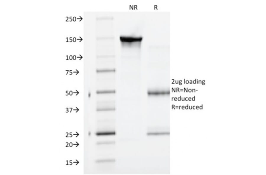 SDS-PAGE - Anti-gamma Catenin Antibody [CTNG/1664] (A249099) - Antibodies.com
