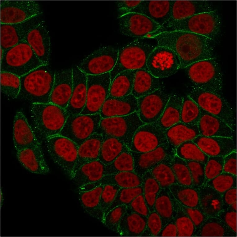 Immunofluorescence - Anti-gamma Catenin Antibody [rCTNG/1664] (A249100) - Antibodies.com