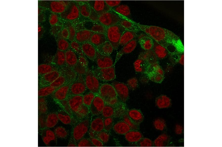 Immunofluorescence - Anti-gamma Catenin Antibody [rCTNG/1664] (A249100) - Antibodies.com
