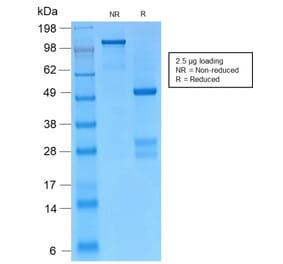 SDS-PAGE - Anti-gamma Catenin Antibody [CTNG/2155R] (A249100) - Antibodies.com