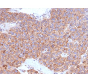 Immunohistochemistry - Anti-B7-H6 Antibody [B7H6/4821] (A249101) - Antibodies.com