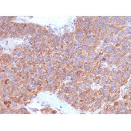 Immunohistochemistry - Anti-B7-H6 Antibody [B7H6/4821] (A249101) - Antibodies.com
