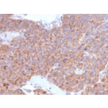 Immunohistochemistry - Anti-B7-H6 Antibody [B7H6/4821] (A249101) - Antibodies.com