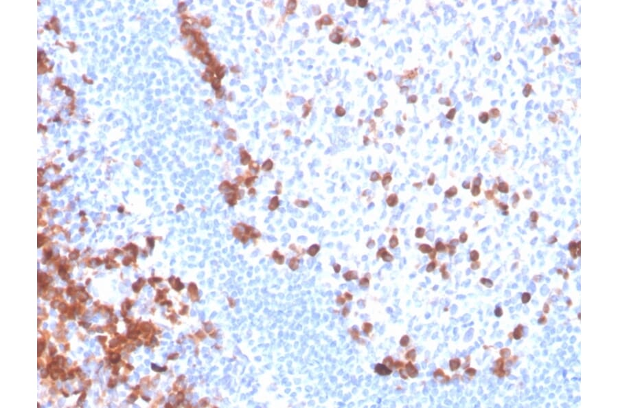 Immunohistochemistry - Anti-B7-H6 Antibody [B7H6/4821] (A249102) - Antibodies.com